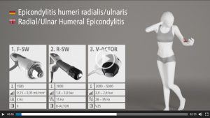 Epicondylite